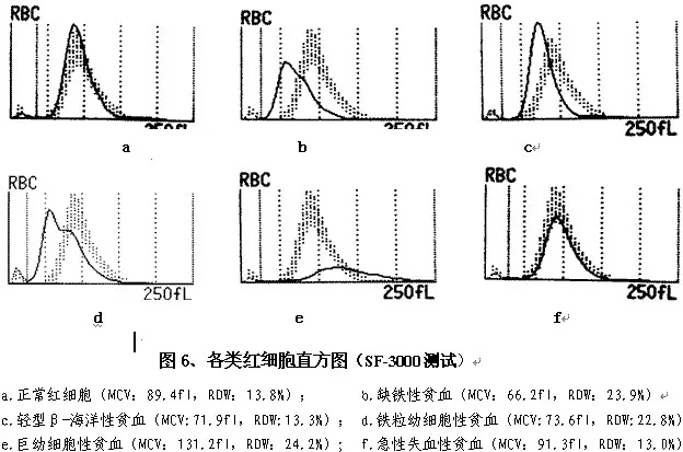 红细胞直方图正确的是