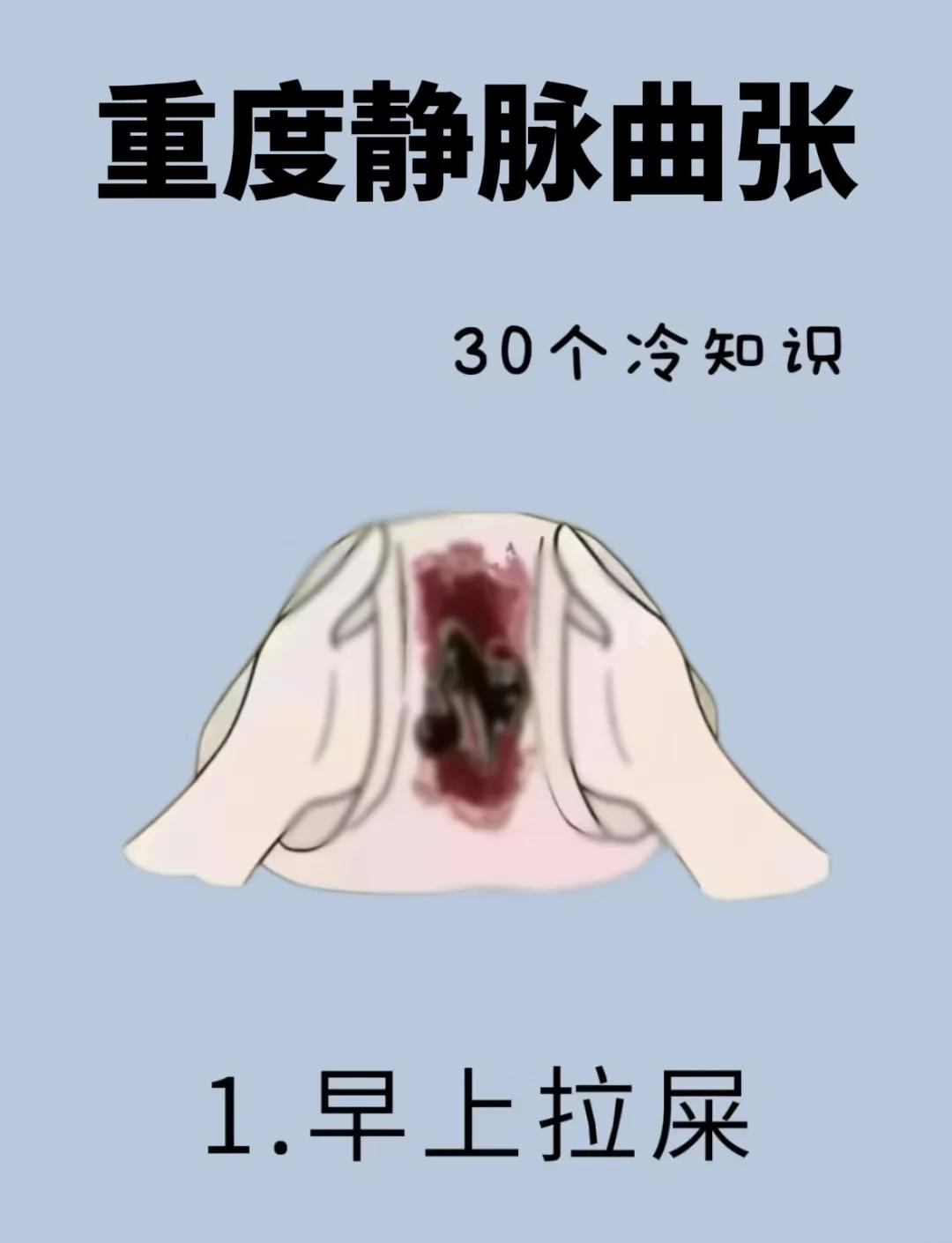 为什么静脉曲张治不好为什么在线 为什么静脉曲张治不好为什么在线