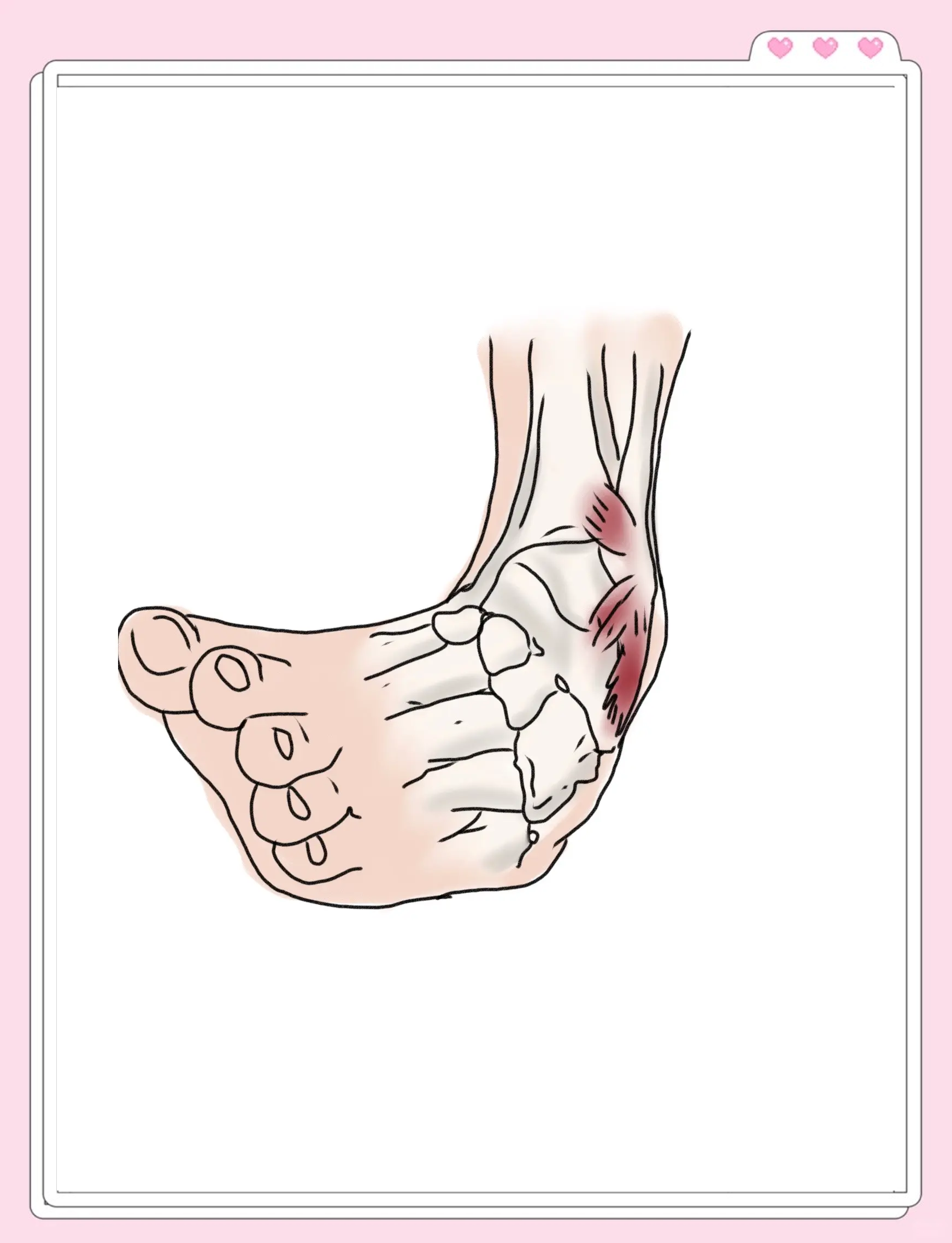 为什么容易崴脚 为什么容易崴脚