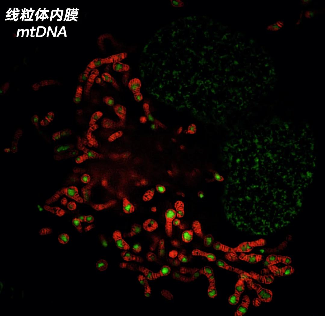 线粒体结构超微病变