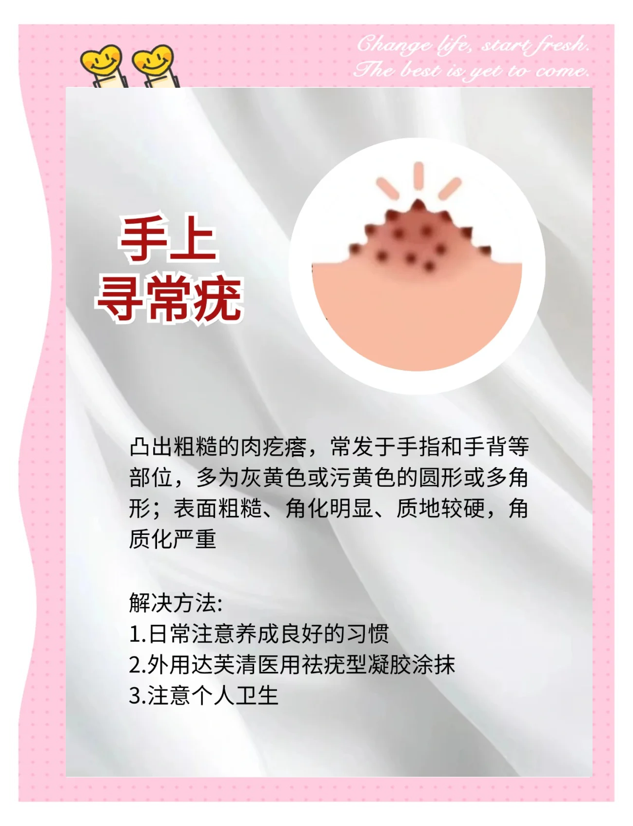 为什么疣体自己消失了