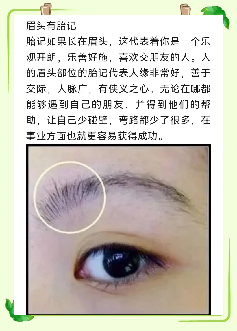 胎记位置