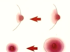 女人乳头为什么会变大的简单介绍 女人乳头为什么会变大的简单介绍