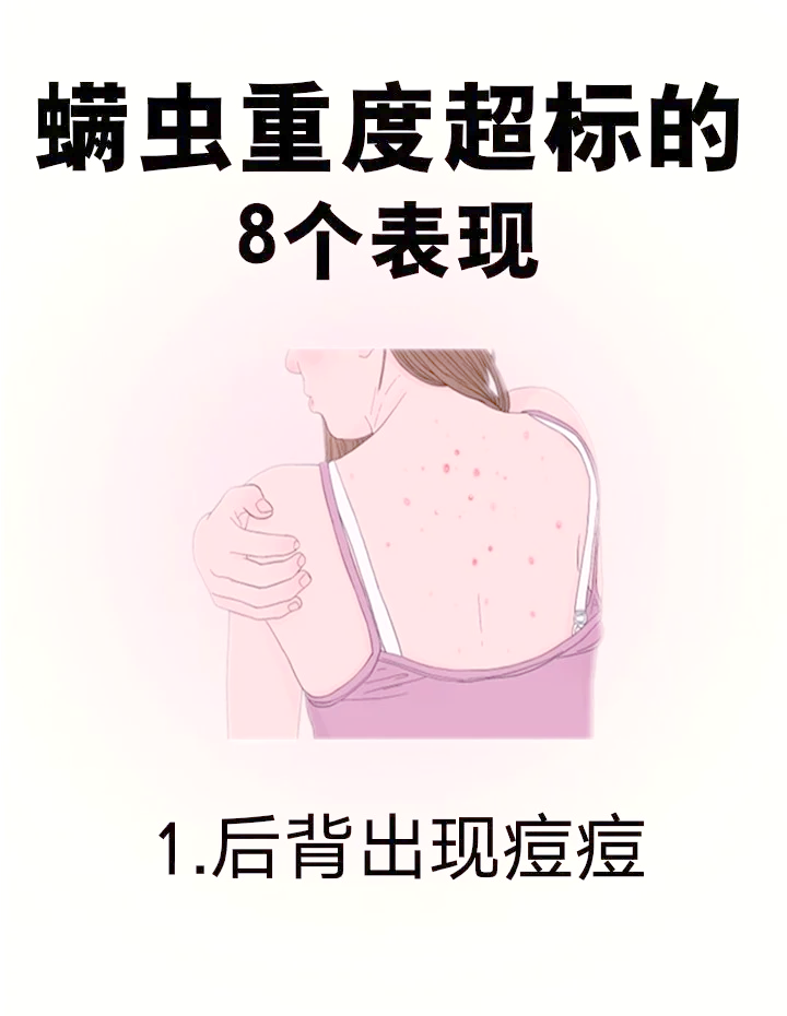 为什么床上会有螨虫