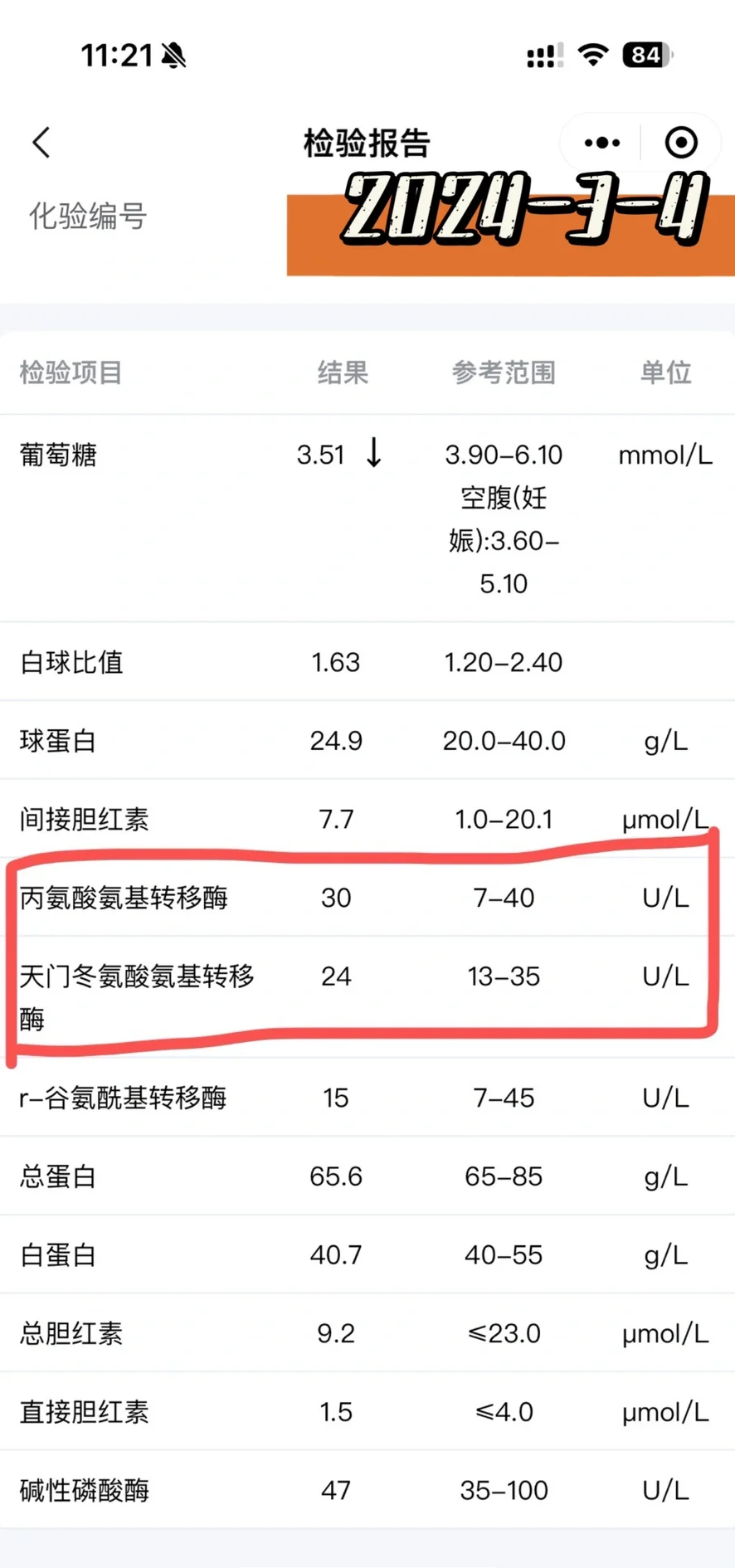 孕妇为什么要查肝功能