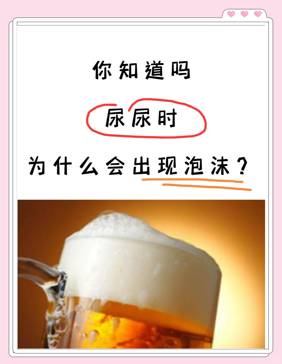 女生小便有泡沫是什么原因百科在线