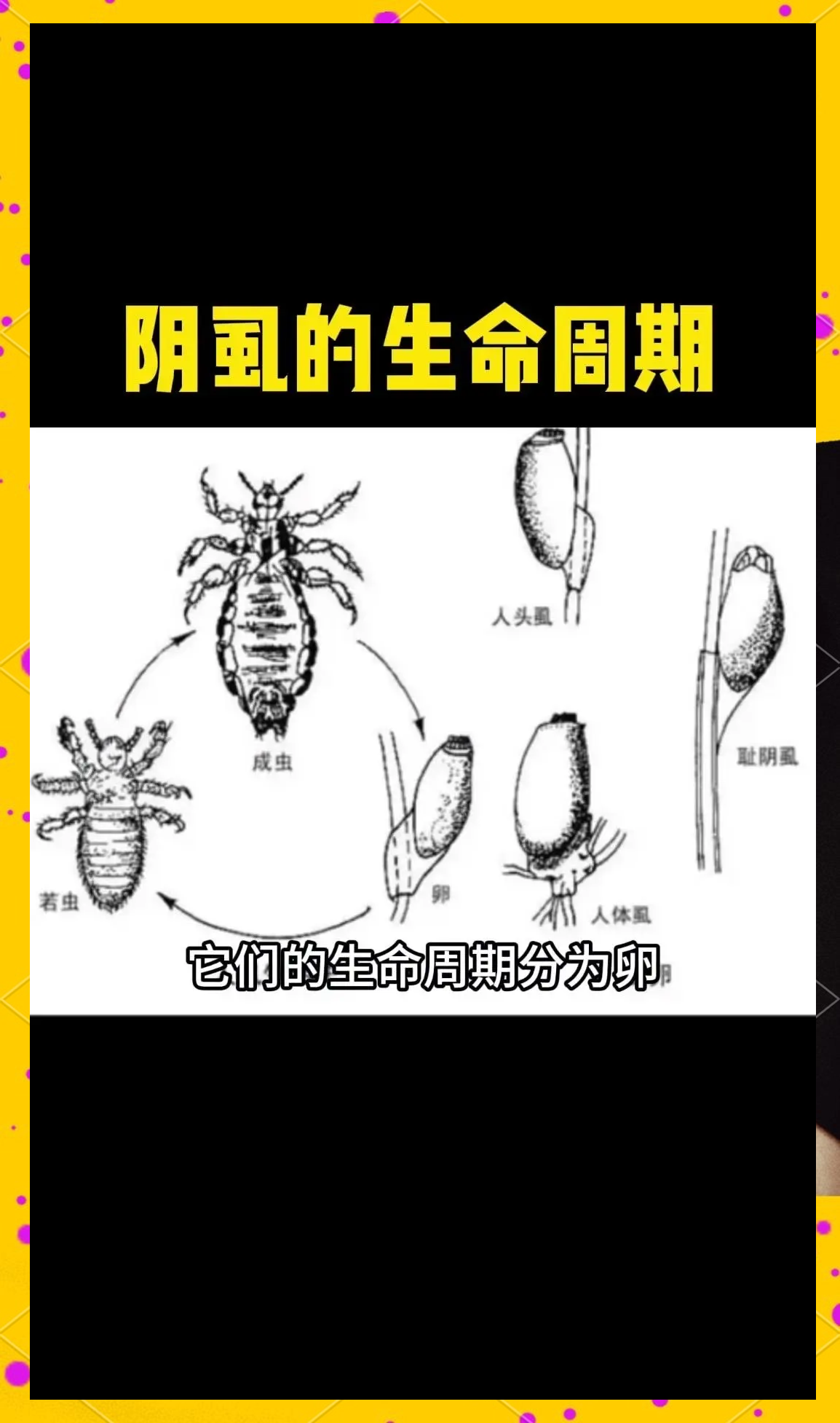 为什么会有阴虱呢怎么治疗为什么在线