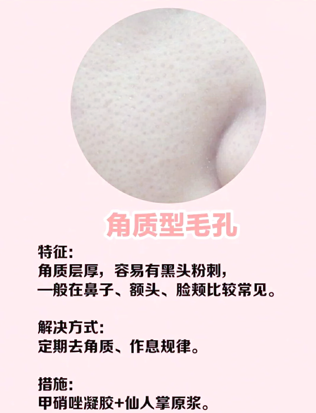 毛孔为什么粗大 毛孔为什么粗大