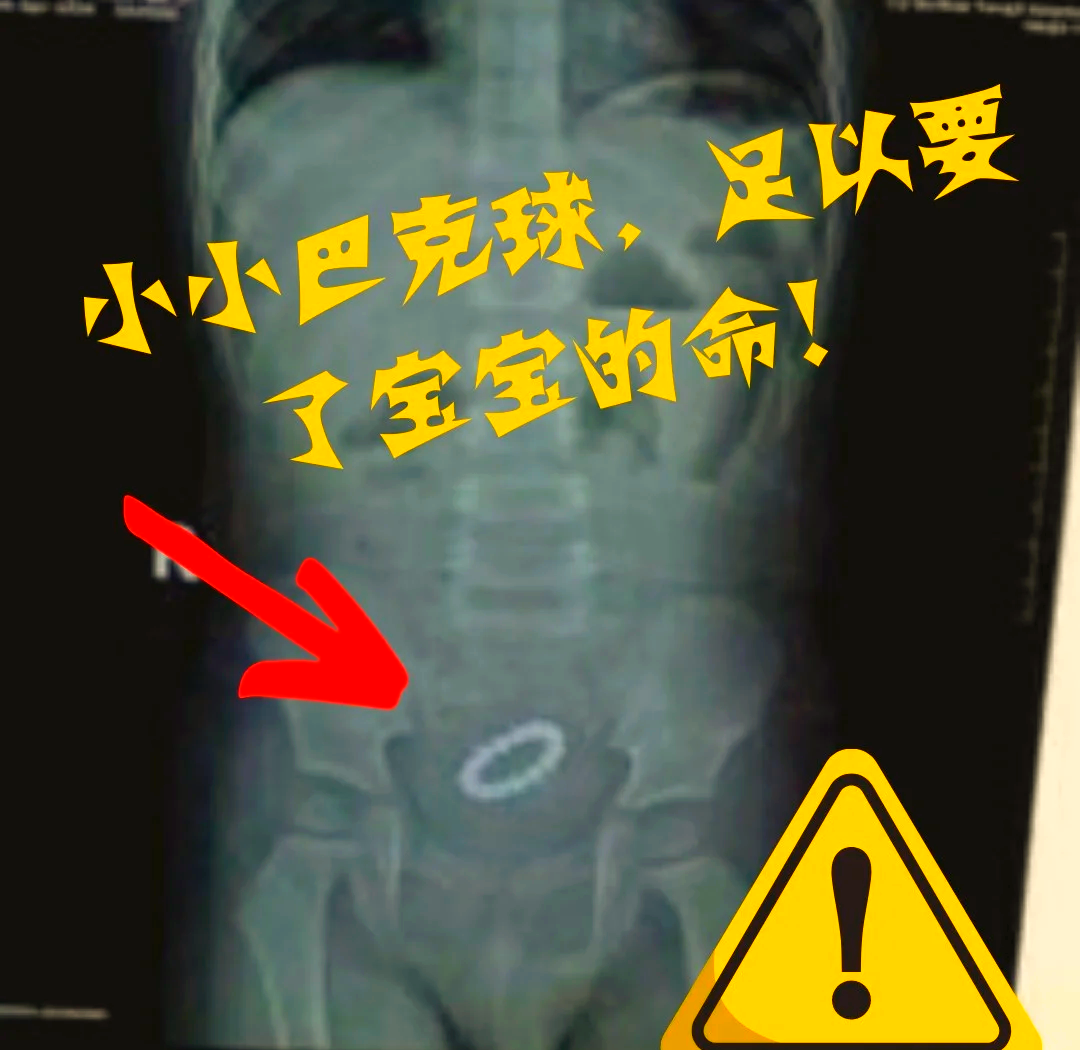 磁力球对孩子有影响吗=磁力球孩子吃了是什么反应