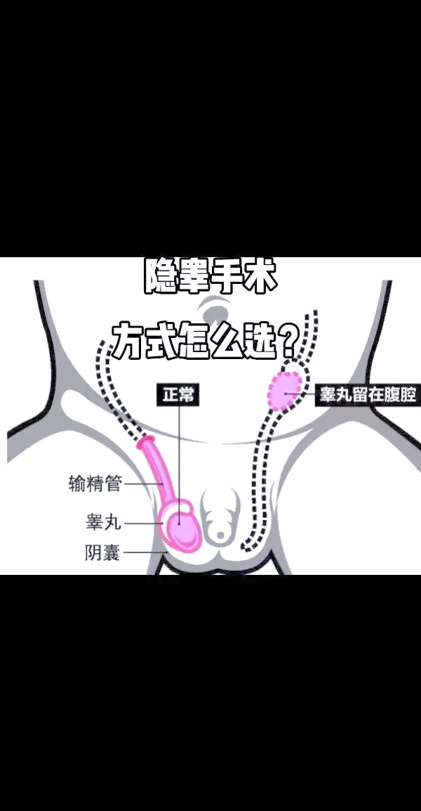 小公猪隐睾丸正确手术图片