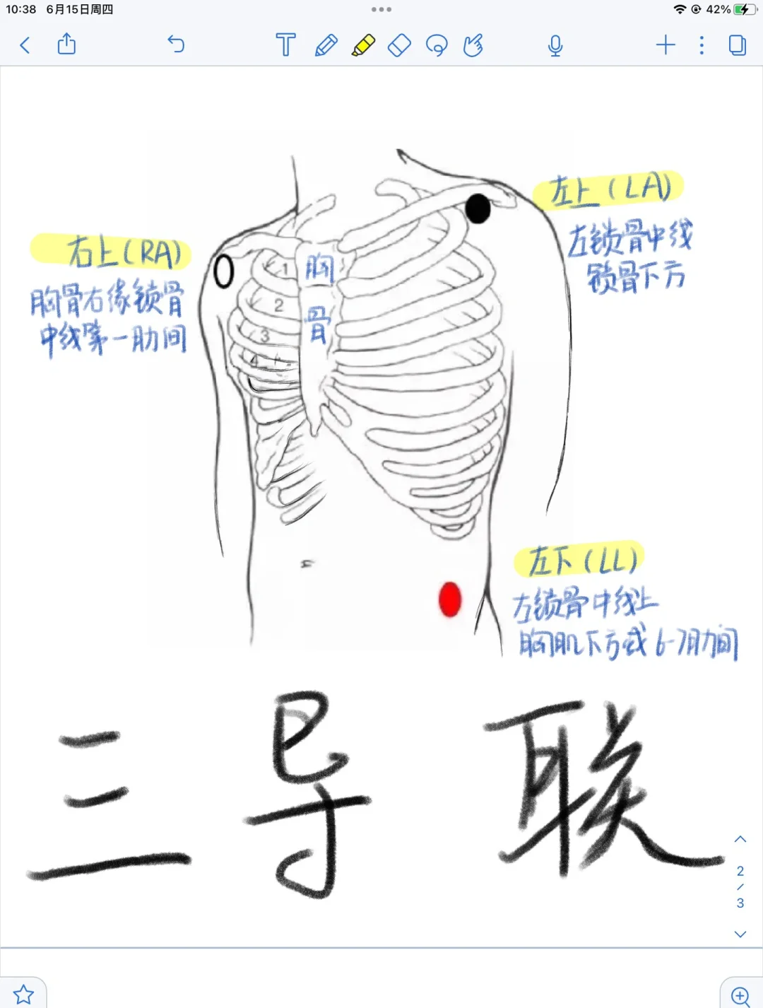 胸导联v1到v6的位置图片