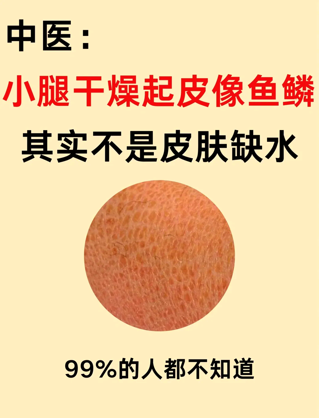 腿上有白皮屑怎么解决图片