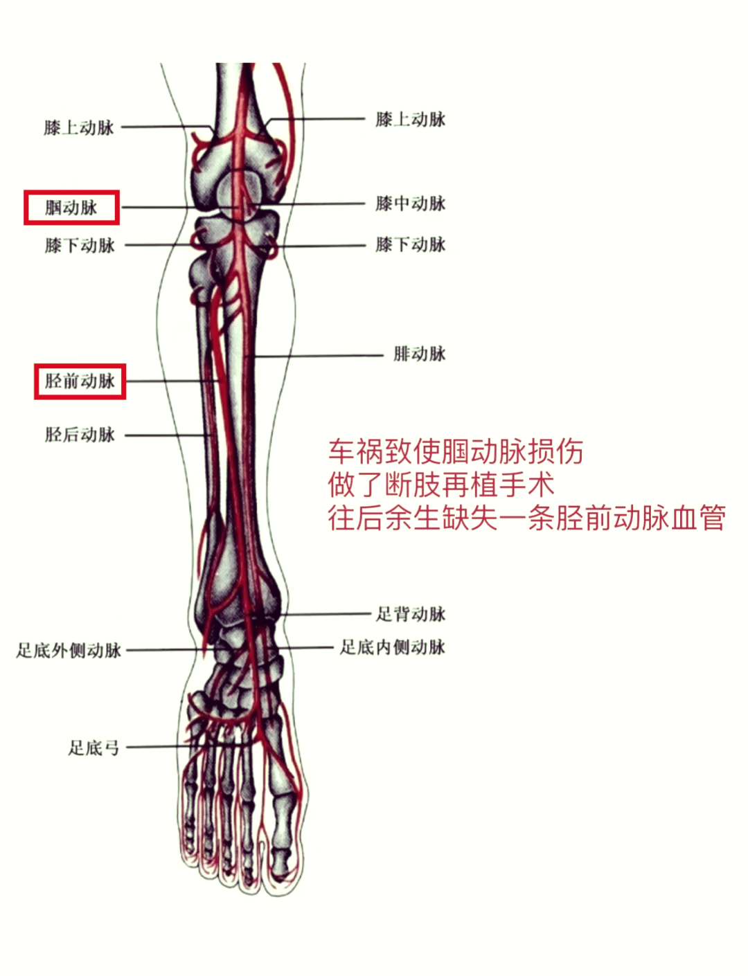 大腿内侧动脉图片图片