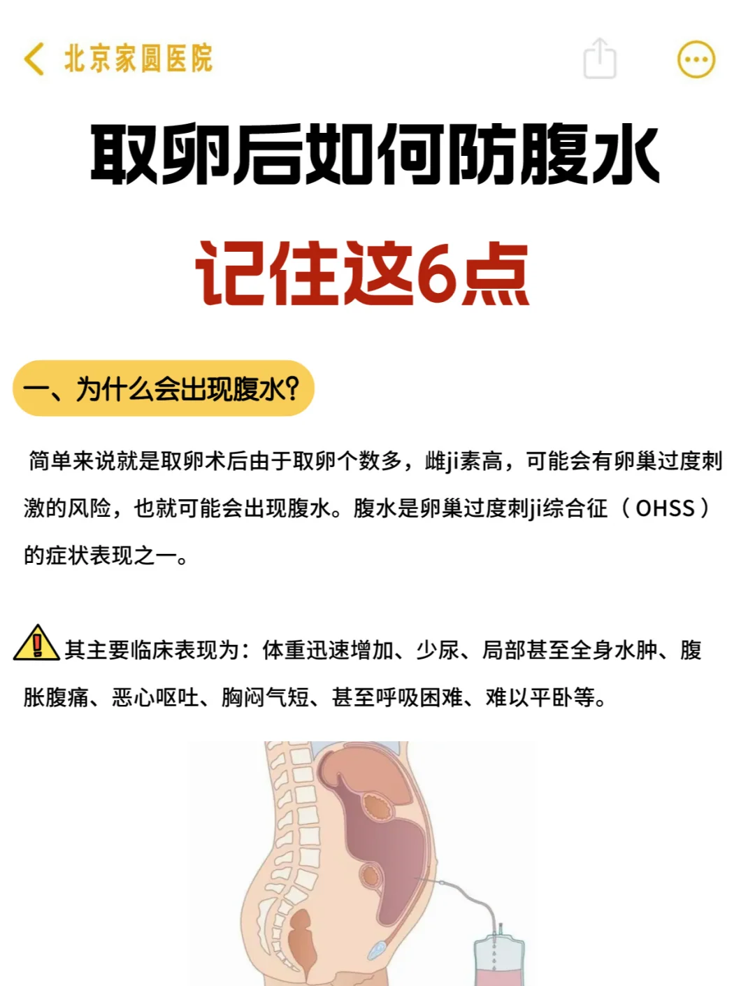 腹水的治疗方法图片