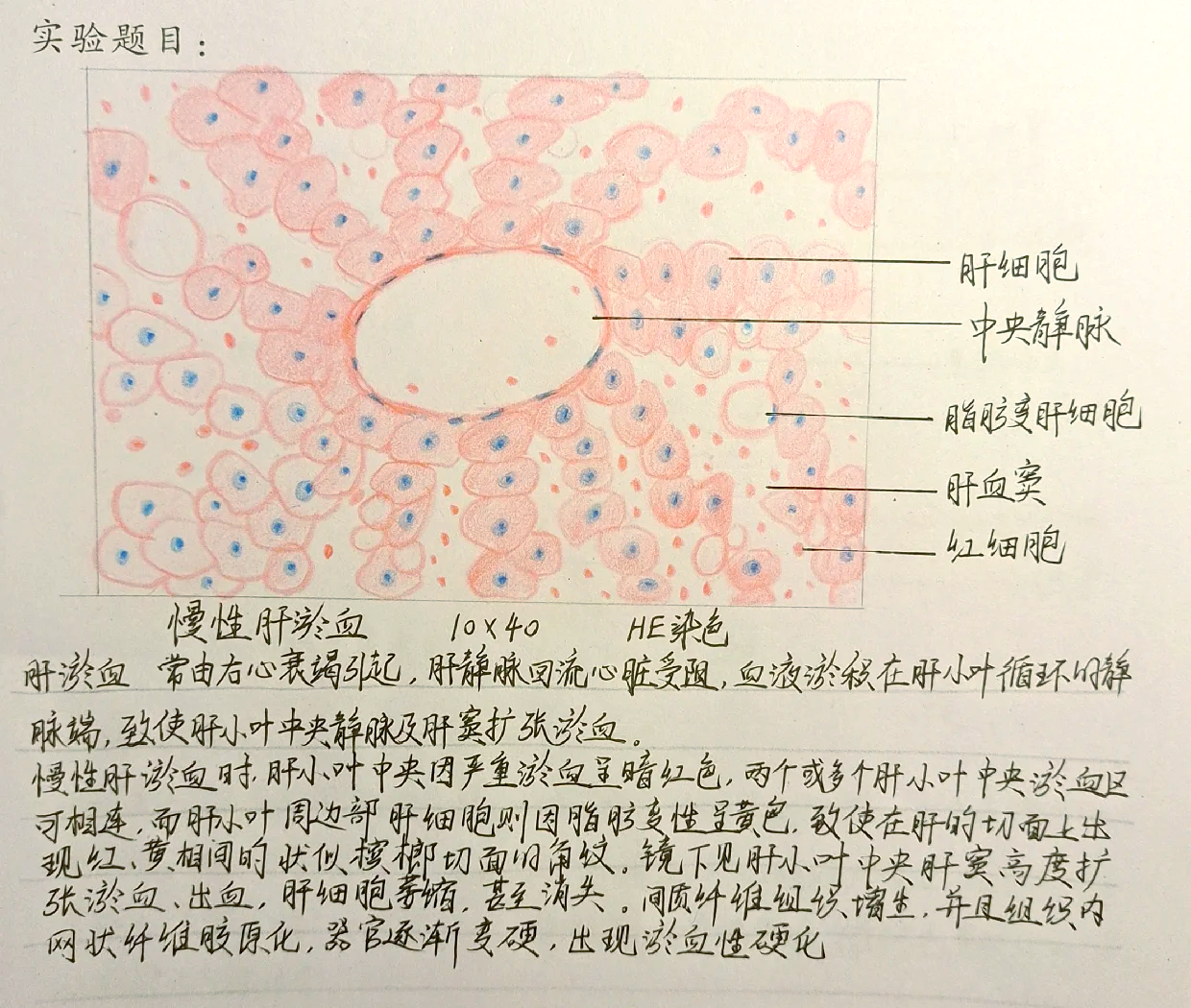 变移上皮切片手绘图图片