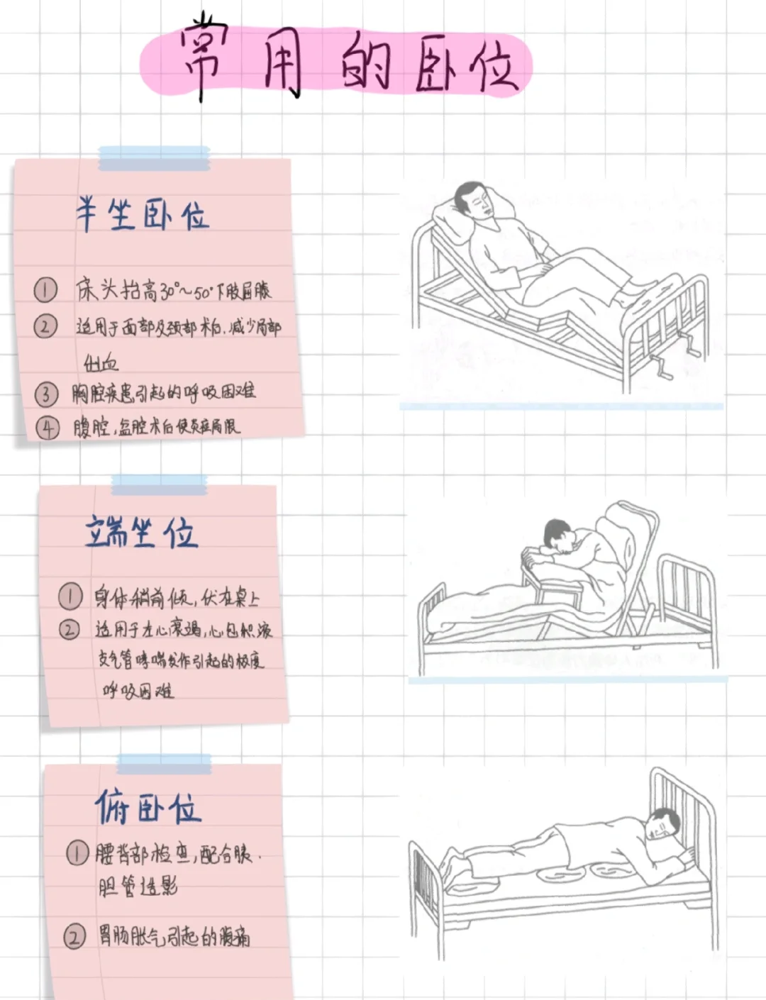 护考必备 常见卧位详解📚