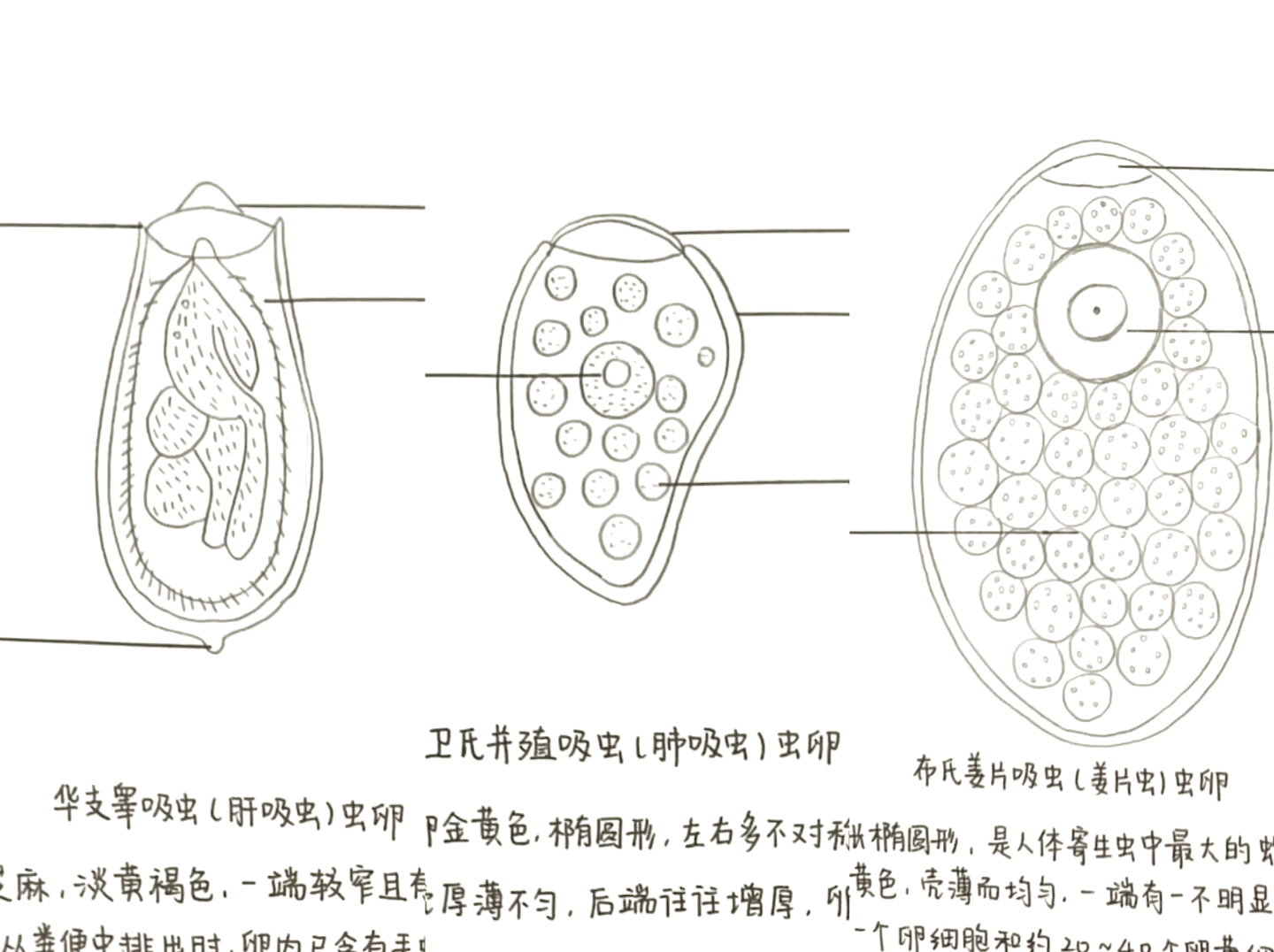 彩蚴吸虫 解剖图片