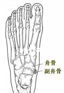 脚内侧面骨头突出图片