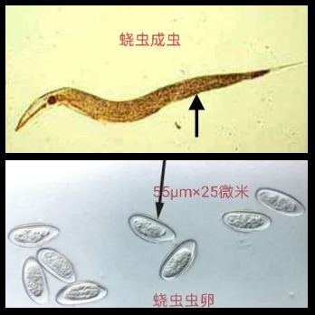 蛲虫的神秘世界 微观视角下的寄生虫