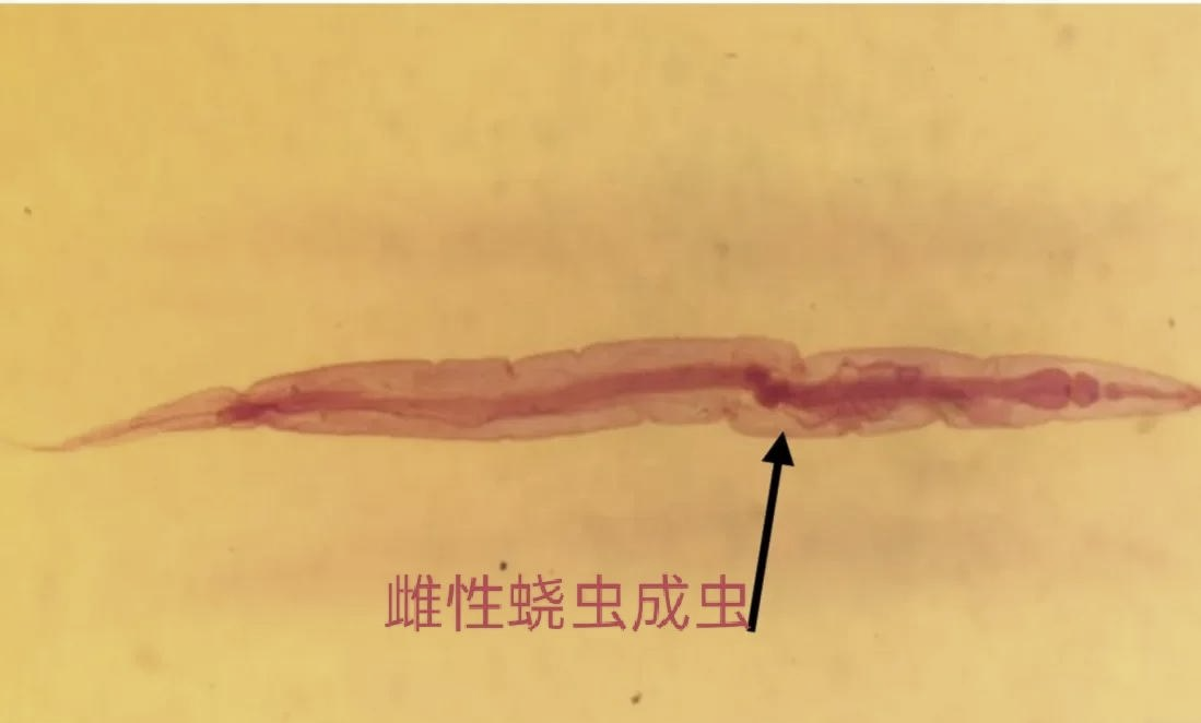 蛲虫的神秘世界 微观视角下的寄生虫