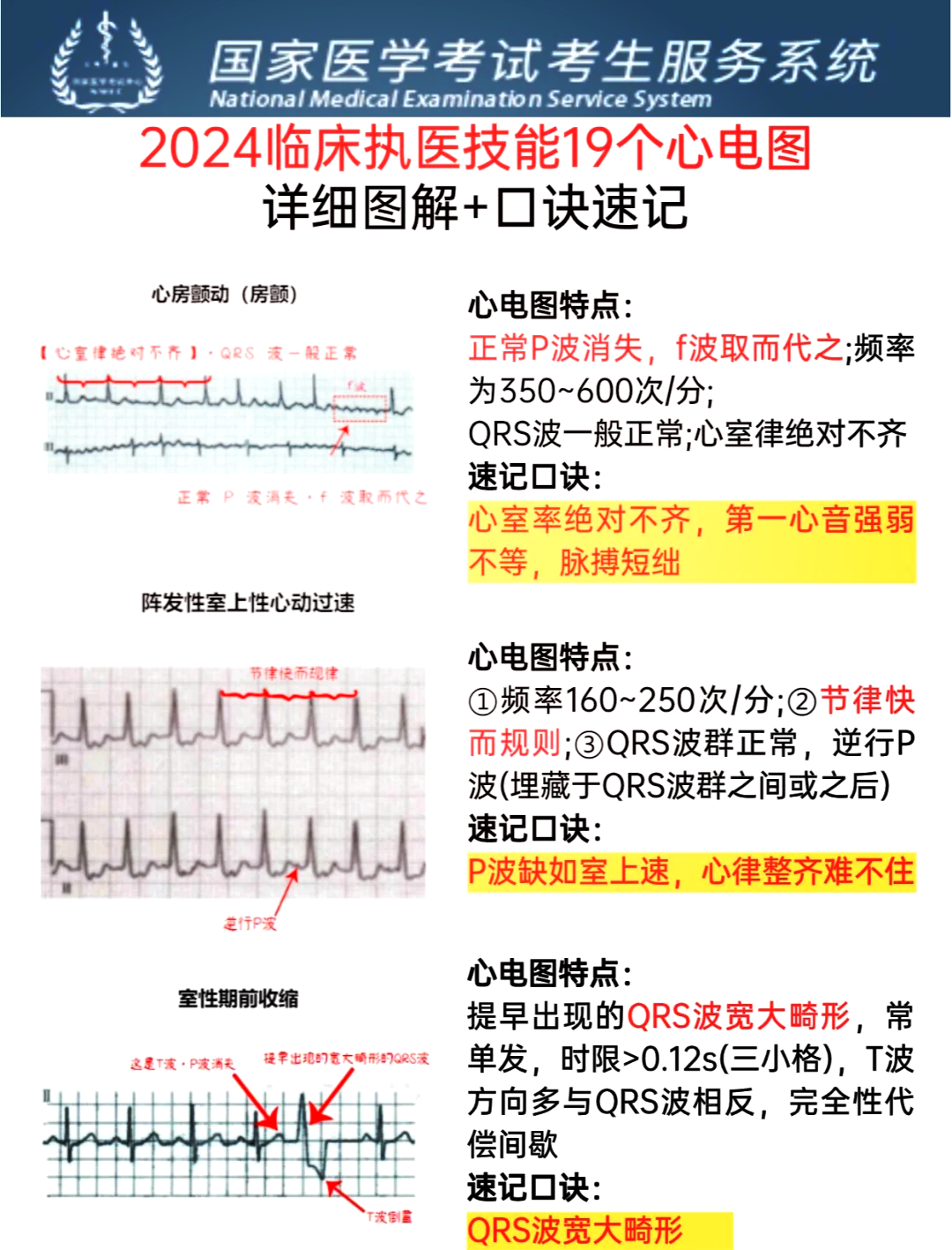 左房增大心电图图片