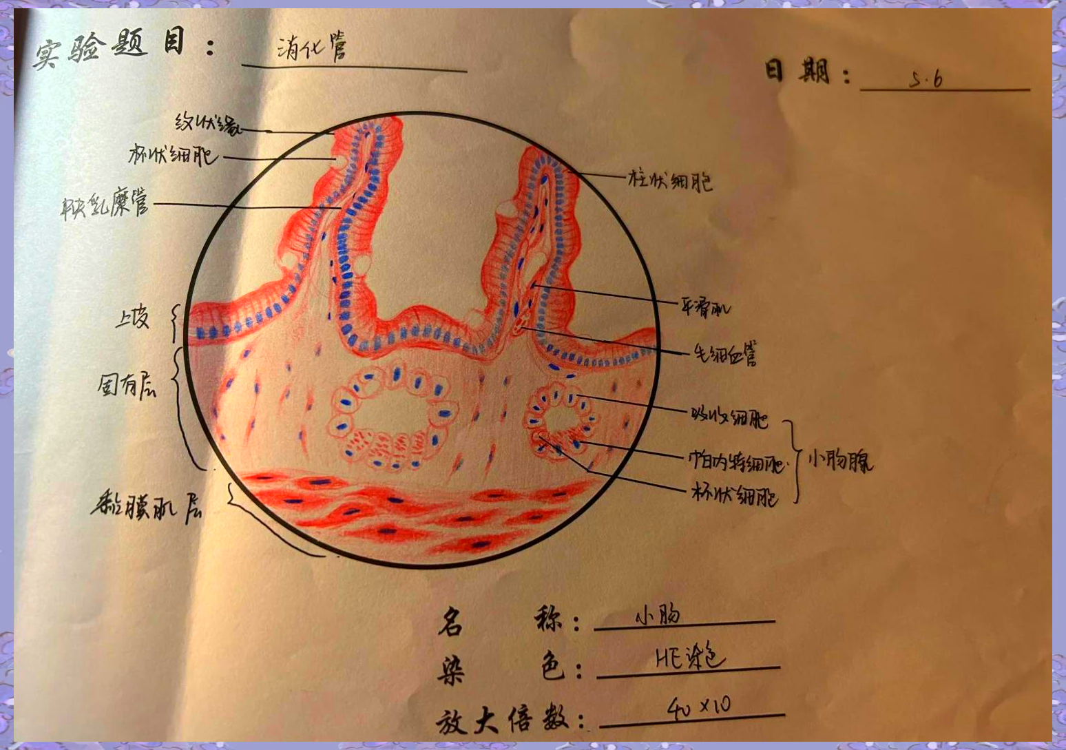 肠伤寒红蓝铅笔图图片