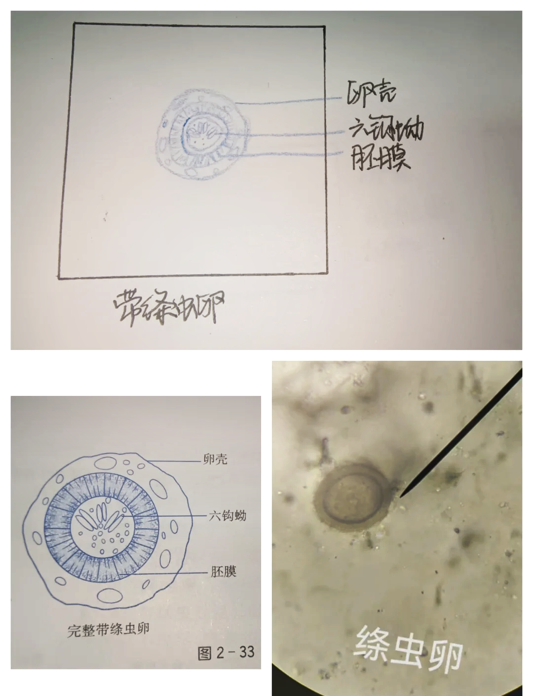 绦虫虫卵形态图片