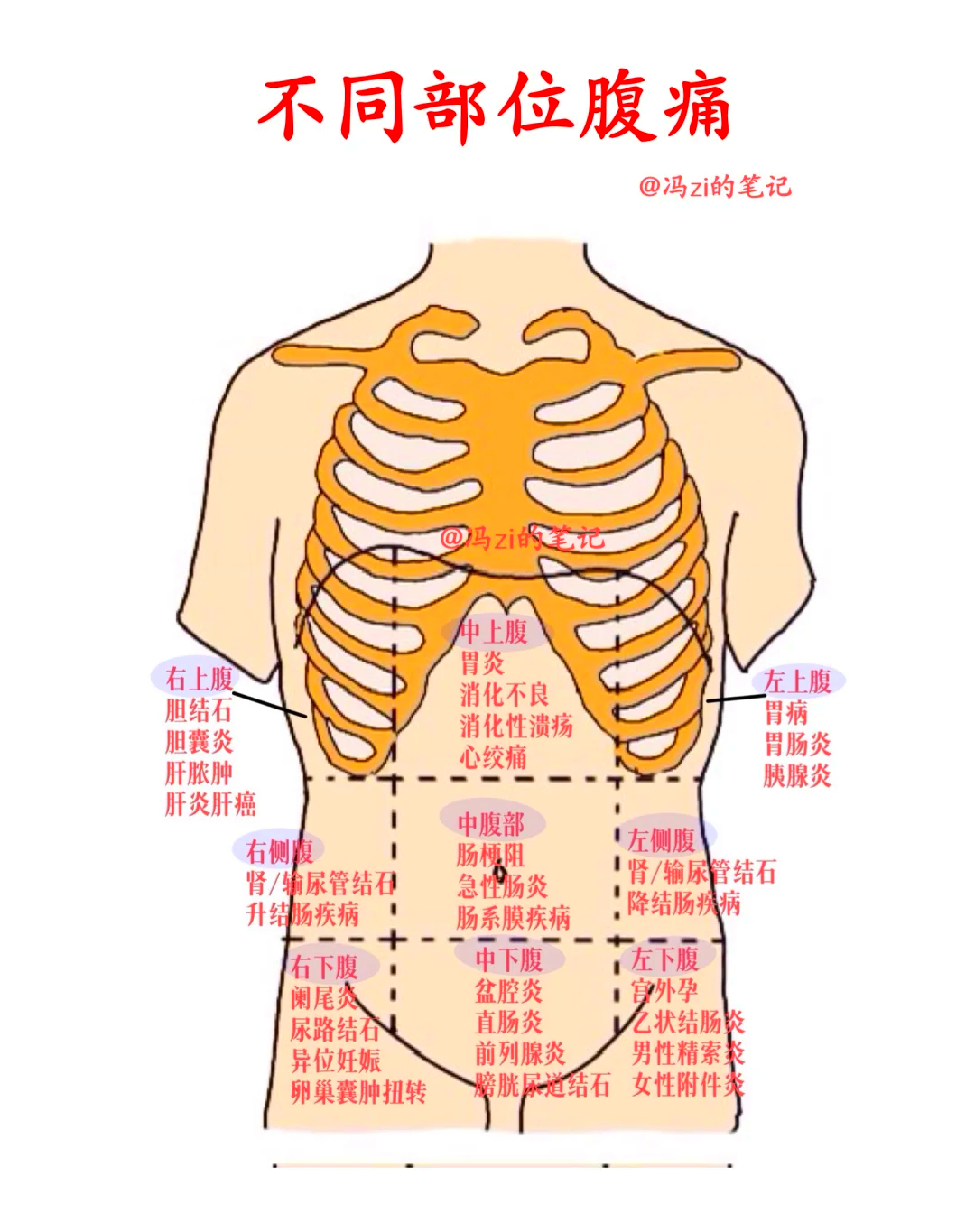 医学笔记整理 不同部位腹痛与腹部分区详解