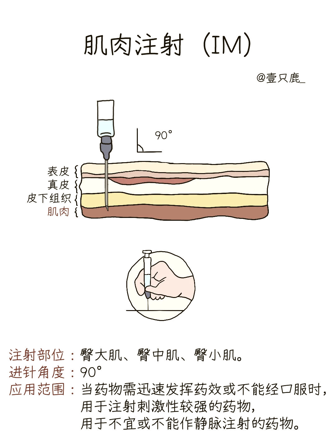 针杆位置示意图图片