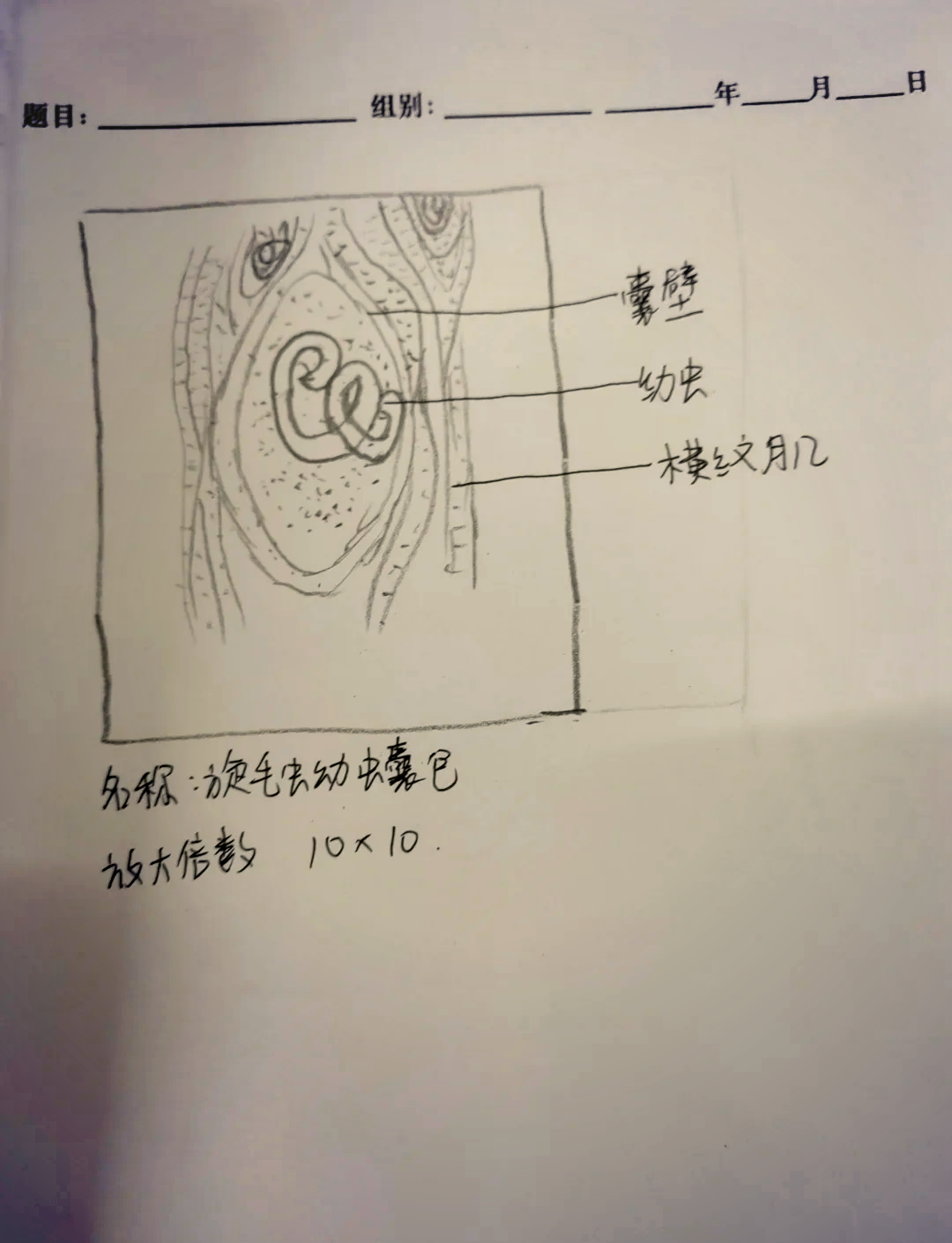 染色体手绘图图片