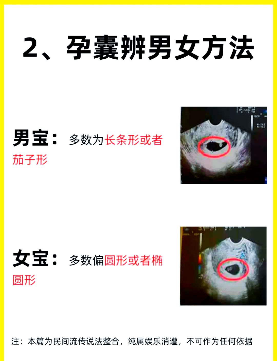 1 看肚型:有人说肚型尖尖的是男孩,圆圆的是女孩哦 2 看孕囊