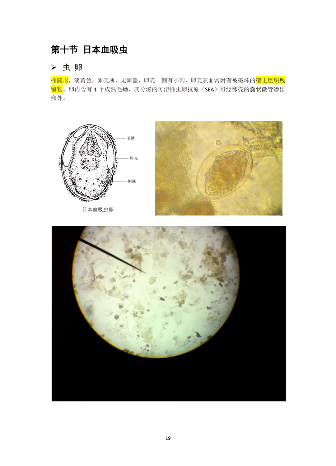 菱角 寄生虫图片