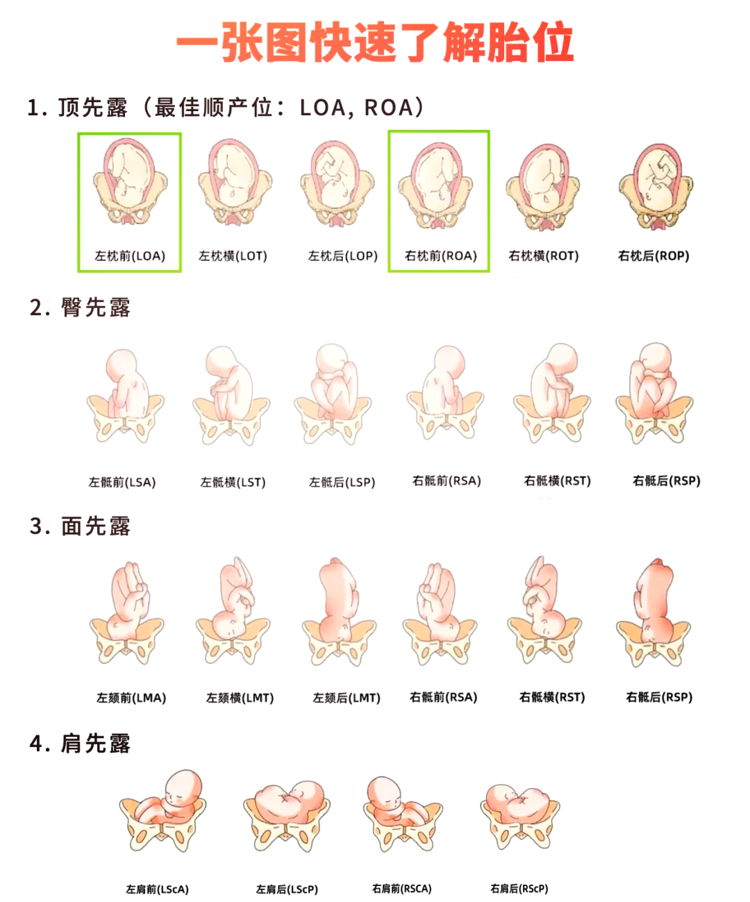 92胎位速览图解92