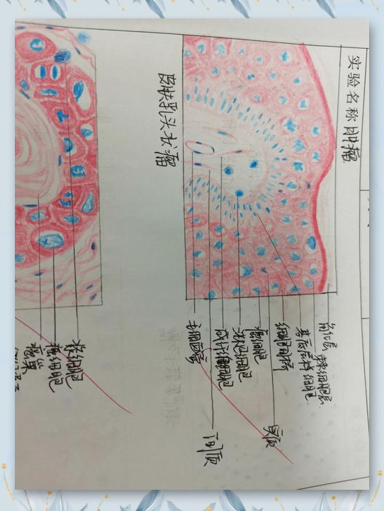 乳腺癌红蓝铅笔手绘图图片