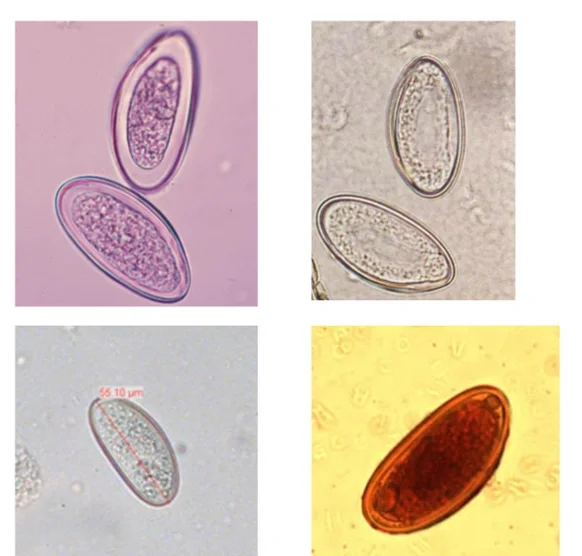 蛲虫卵的形态与感染途径详解