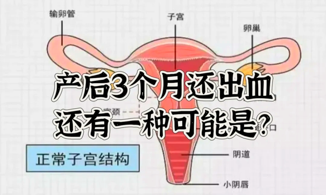 怎么生孩子流血图片