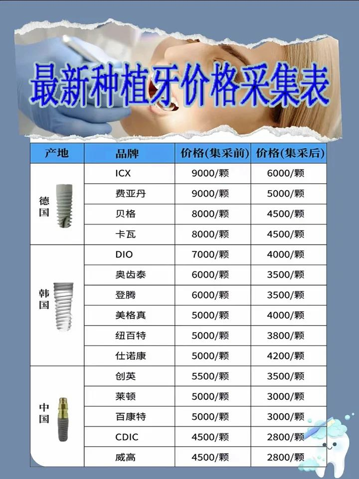 全口种植牙价钱图片