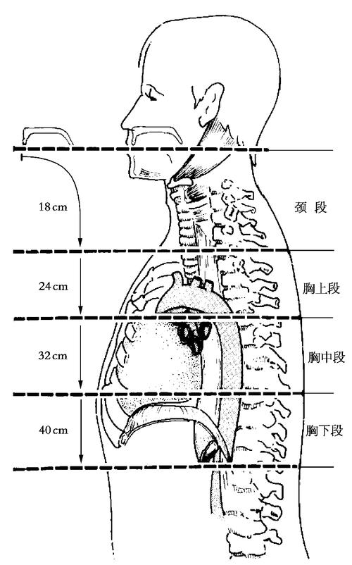 食管三个狭窄图片