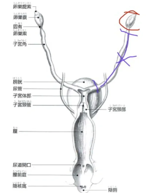 畸形子宫形态图片