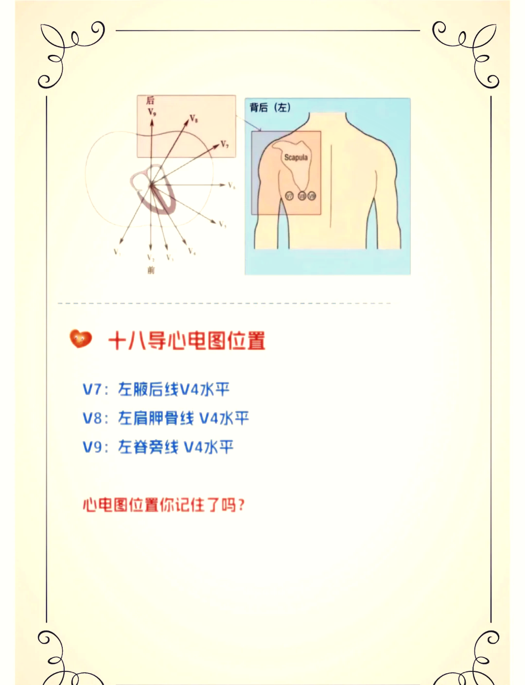 十八导心电图颜色位置图片