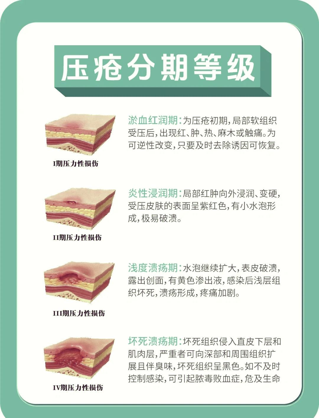 压疮分期最新标准图片图片