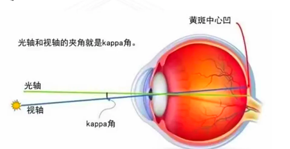 kappa角测量方法图片