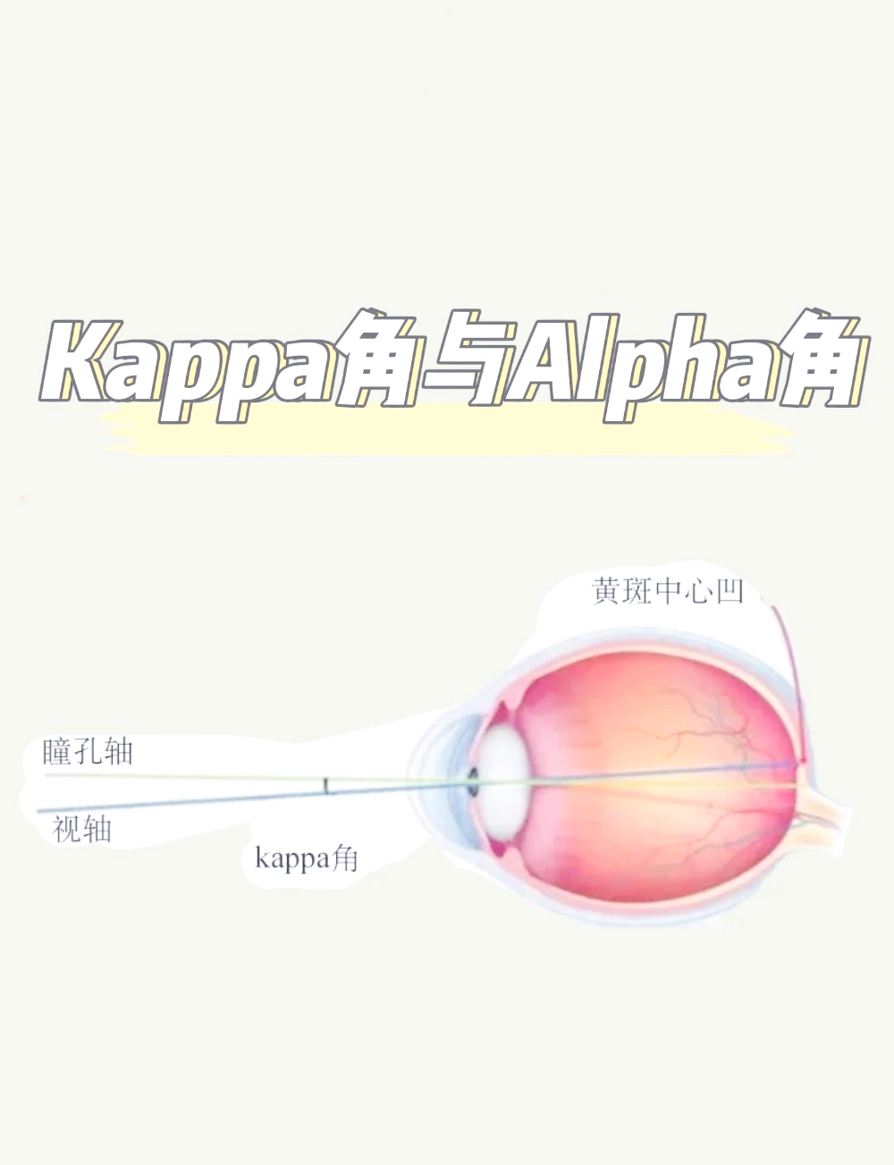 kappa角测量方法图片