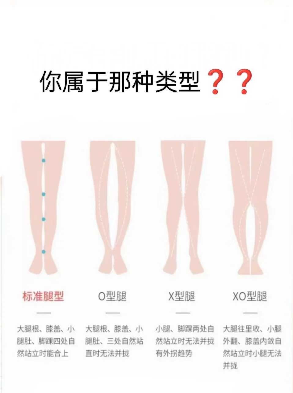 轻微xo型腿图片图片